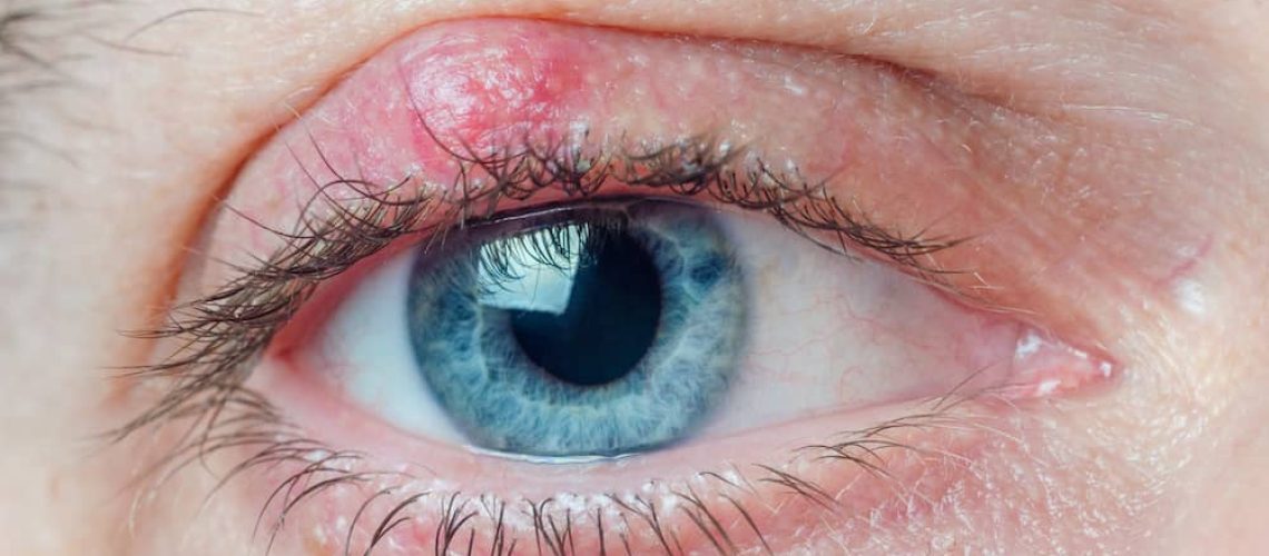 دکتر شالازیون