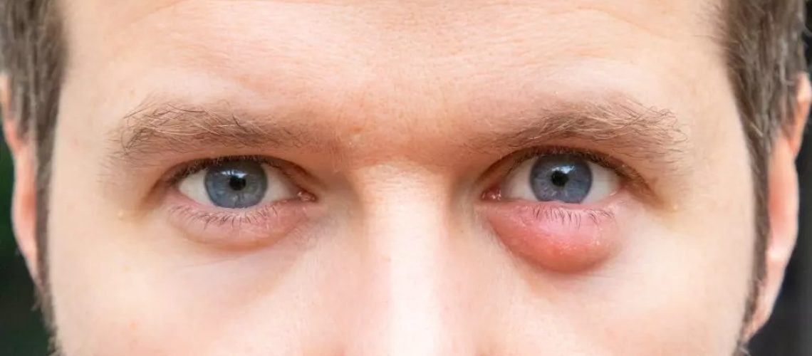 دکتر گل مژه